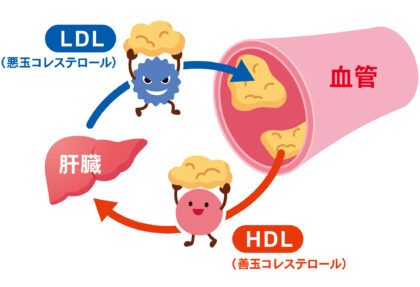 脂質異常症とは