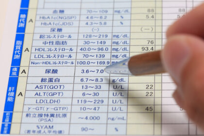 高尿酸血症（尿酸値の異常）